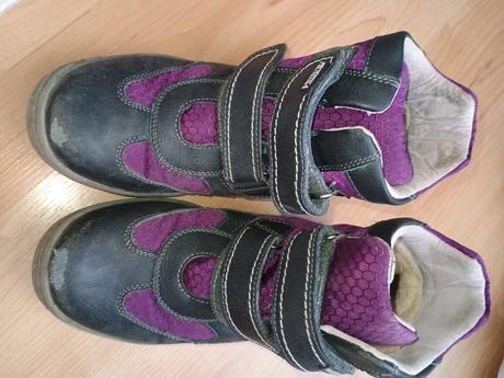 Čižmy protetika, protetika,34