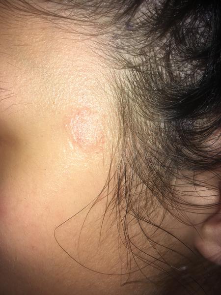 Čo to je na mojej tvári a nohe?