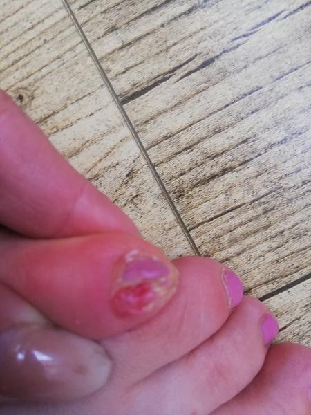 Zvláštne výrastky pri nechte