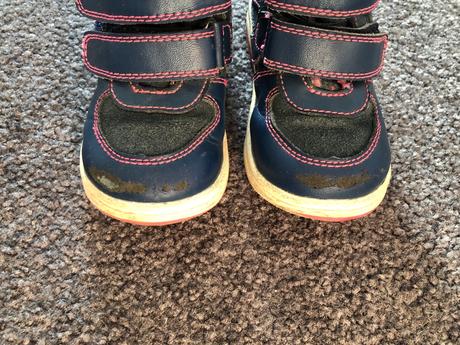 Zimne čižmy protetika, protetika,23