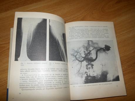 Vnútorné lekárstvo,