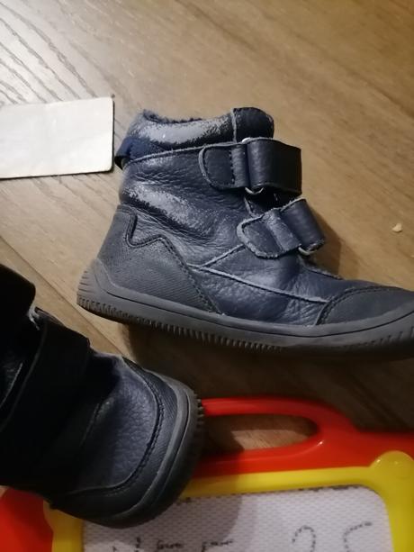 Topánky, protetika,25