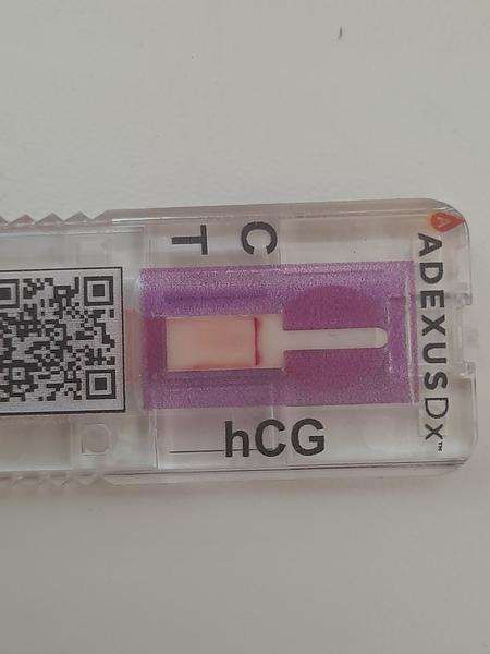 Ako si mám vysvetliť tento krvný test?