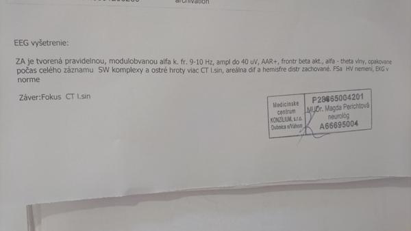 Čo je zlé na mojich EEG výsledkoch?