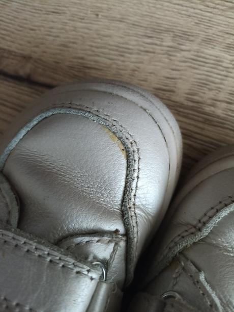 Protetika barefoot jarné topánky, protetika,23