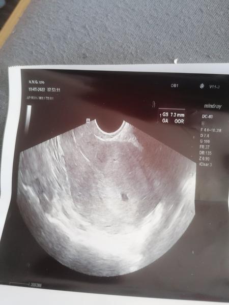 Menzes mi mešká 7 dní