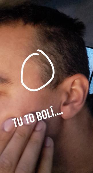 Bolesť v pravom spánku: Možné príčiny a riešenia