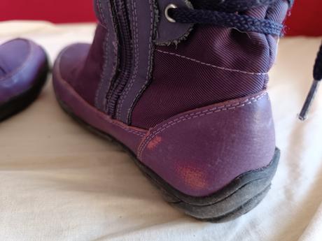 Čižmy, protetika,34