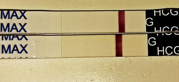 Bude to čiarka alebo kanálik?