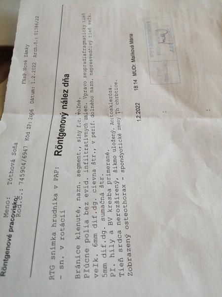 Aký je záver môjho RTG snímku?