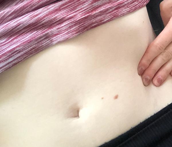 Čo môže spôsobovať bolesť hlavy a nevoľnosť?