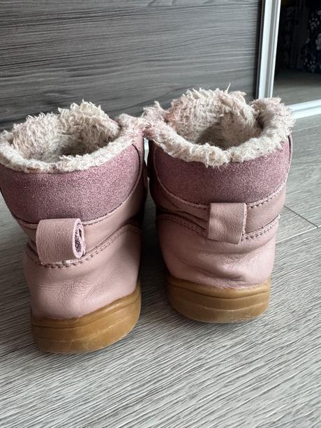 Zimne topanky protetika barefoot, protetika,29