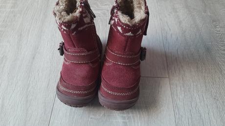 Čižmičky, protetika,20