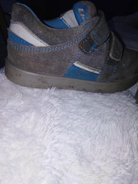 Detské tenisky, protetika,28