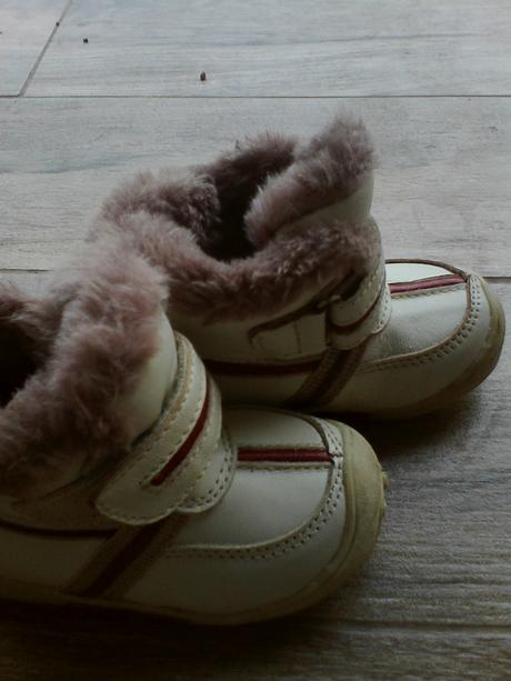 Zimne topanocky, protetika,20