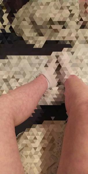 Fľaky, horúčka, hnačka a zimnica - čo to mohlo byť?