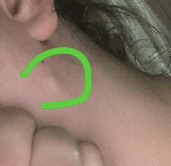 Čo to mám na krku?