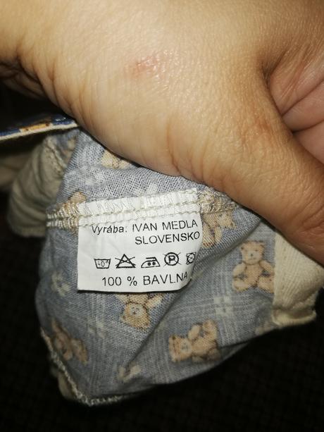 Tenka letna siltovka, 62