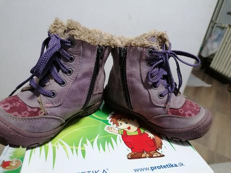 Krasne zimné topánočky protetika, protetika,24