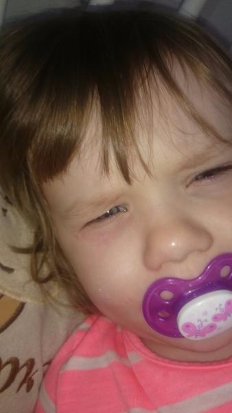 Fliačik okolo očka