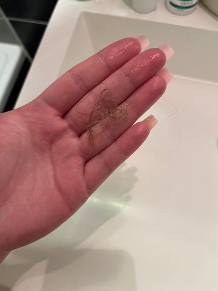 Vypadáva vám veľa vlasov napriek starostlivosti?