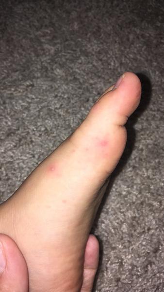 Boli to ovčie kiahne?