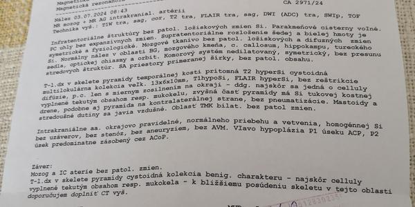 Čo odhalí magnetická rezonancia hlavy?