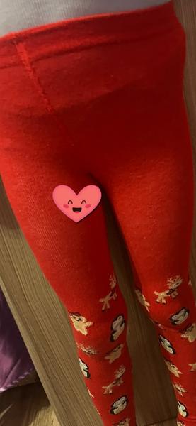 Bolesť stehna u detí: Možné príčiny?