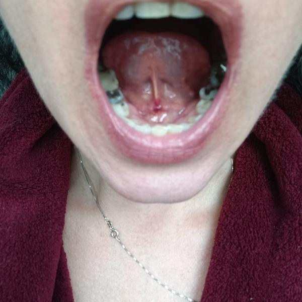 Biela hrčka na uzdičke jazyka