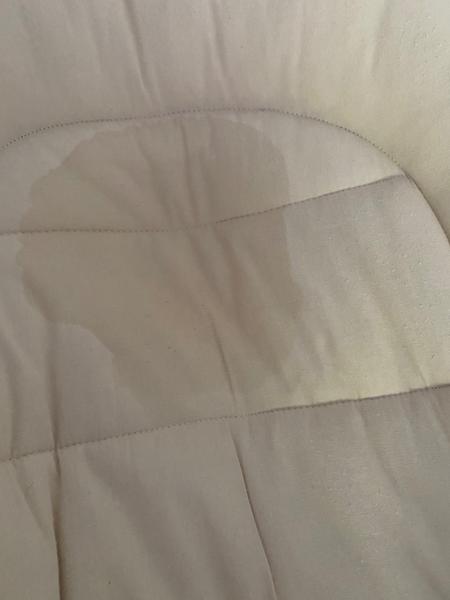 Ako liečiť zapareniny pod krkom, pazuchami a v záhyboch na lakti u 3-mesačnej dcérky?