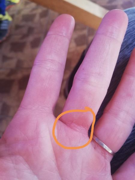 Akú hrčku to mám na prste?