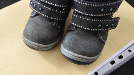 Čižmy protetika, protetika,22