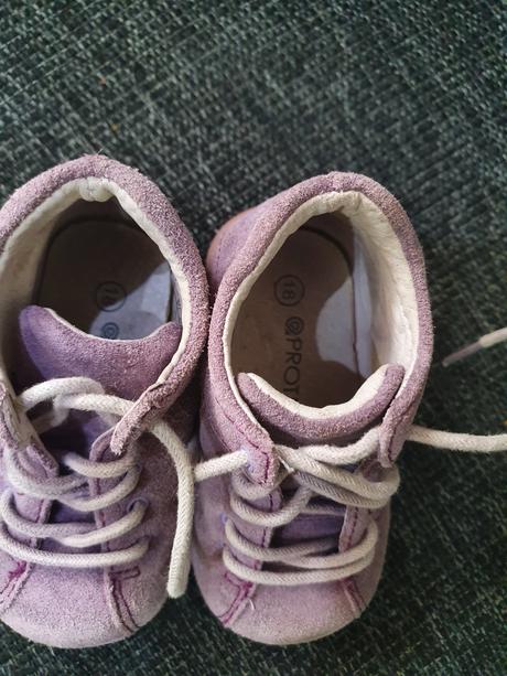 Ortopedicke topanocky protetika, protetika,18