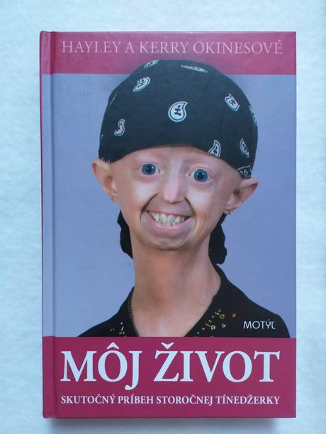 Môj život, skutočný príbeh storočnej tínedžerky,