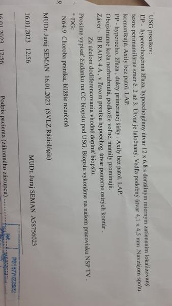 Vie lekár podľa USG určiť, či sa jedná o nezhubný nádor?