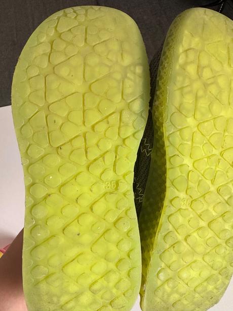 Tenisky na telesnú 35, 35