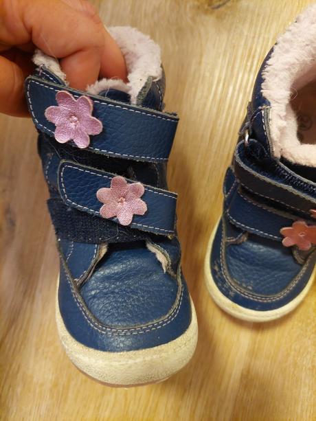 Zimne protetika 24, protetika,24