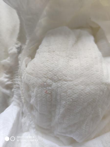 Čo znamenajú ružové fľaky na plienke?