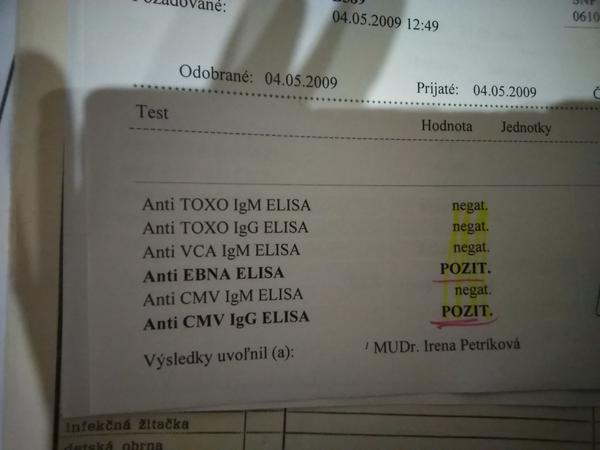 Vysvetli mi niekto tieto hodnoty?