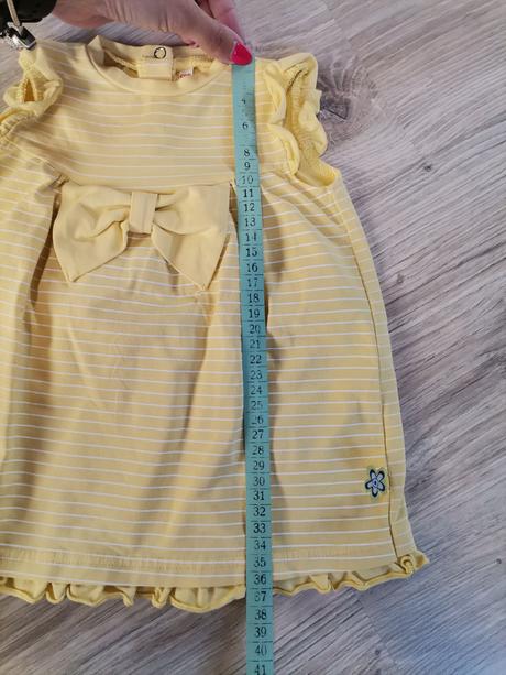 Dievčenské žlté šaty, coccodrillo,62