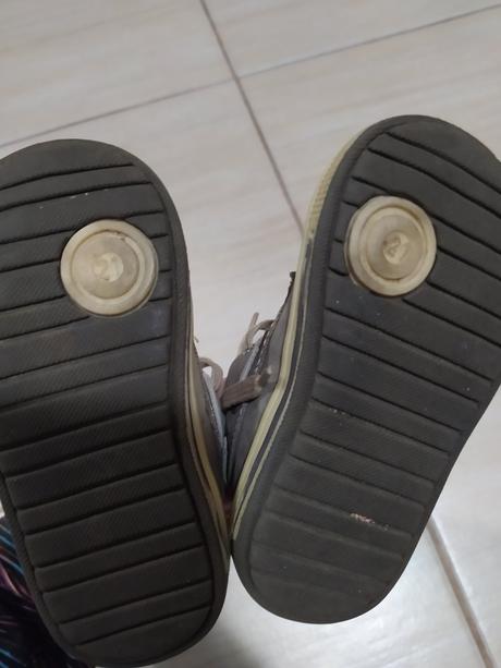 Ortopedické topánočky, protetika,21