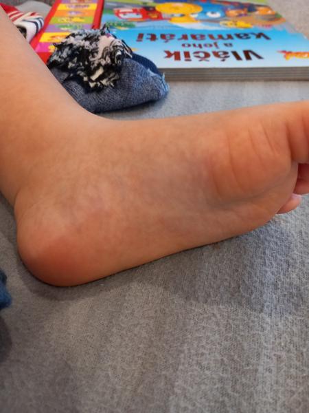 Je toto šiesta choroba u dieťaťa?