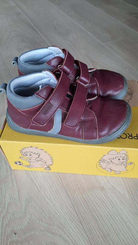 Prechodne barefoot topanky, protetika,31