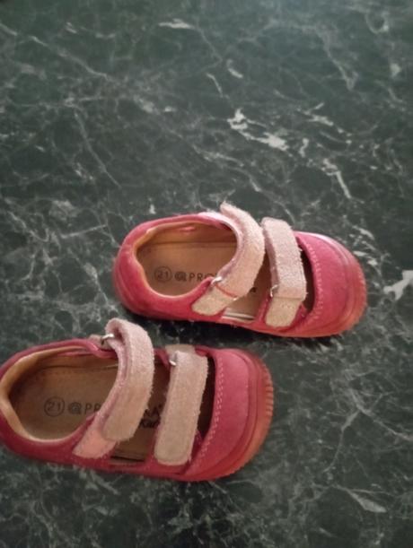 Sandálky protetika, protetika,21