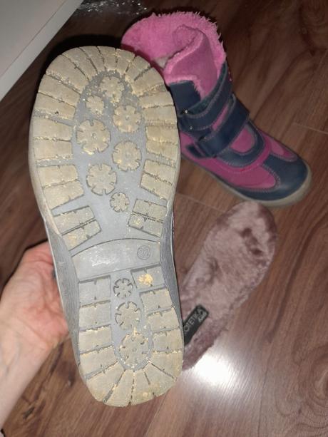 Čižmy sú, protetika,32