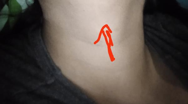 Keď zohnem hlavu, tak cítim ako keby mi niečo tlačilo. Aké vyšetrenia mi odporúčate?