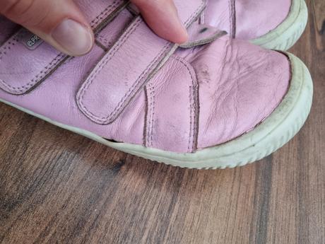 Barefoot topánky protetika, protetika,35