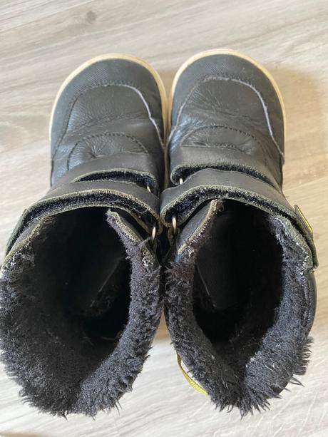 Zimne topanky protetika barefoot, protetika,31