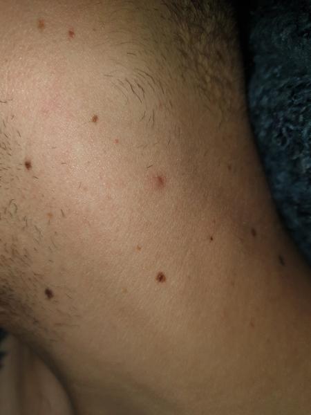 Čo mi pomôže na vredy?