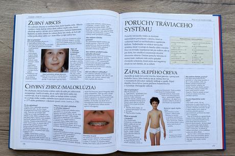Kniha-sprievodca detskými chorobami za 5e, 